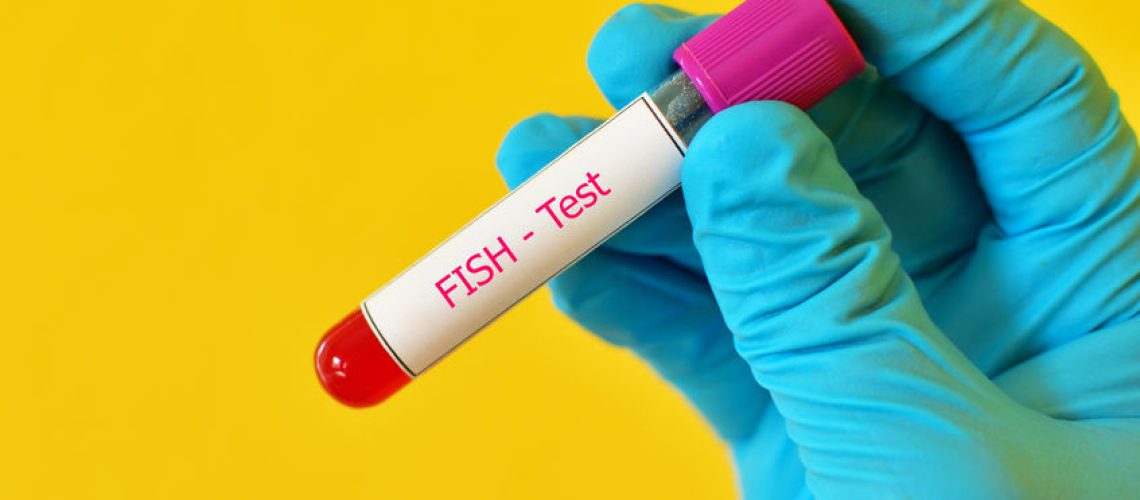 Síndrome de Klinefelter