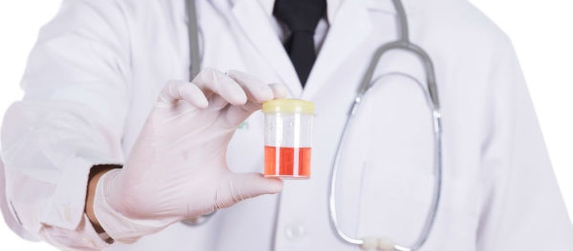 sangue na urina
