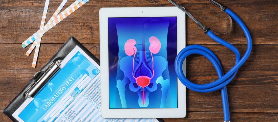 Urologia Oncológica