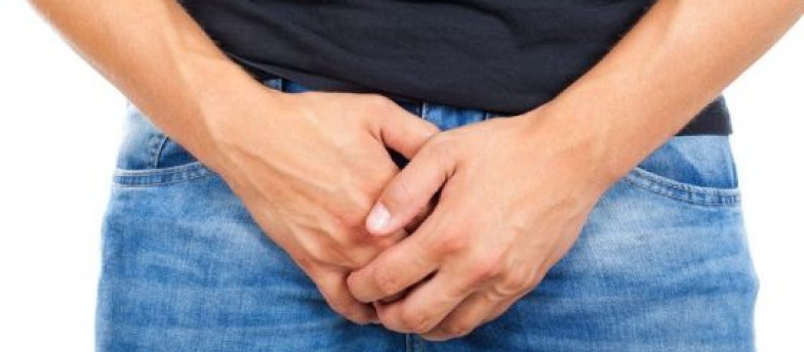 Varicocele